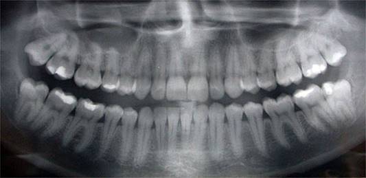 dientes.jpg